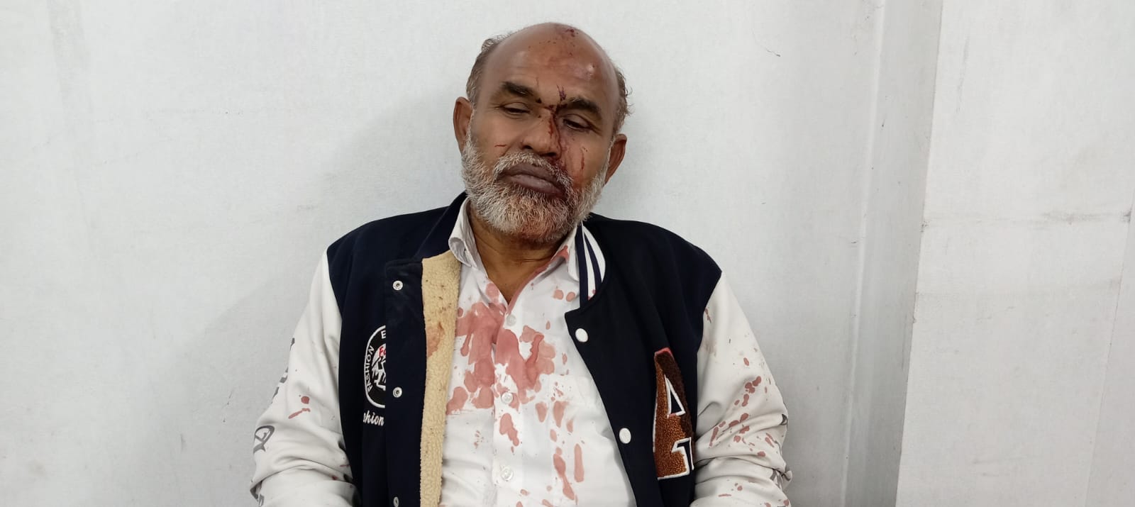 টেকনাফে পূর্বশত্রুতার জেরে আপন দুই ভাইয়ের নৃশংস হামলায় গুরুতর আহত এক ভাই