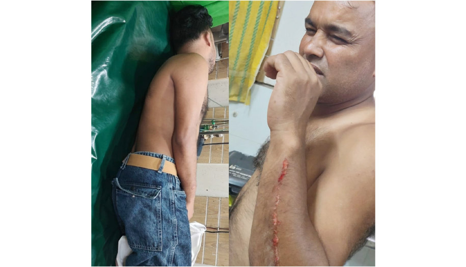 রামুতে জমি দখল নিয়ে সংঘর্ষ, দুই ভাই আহত