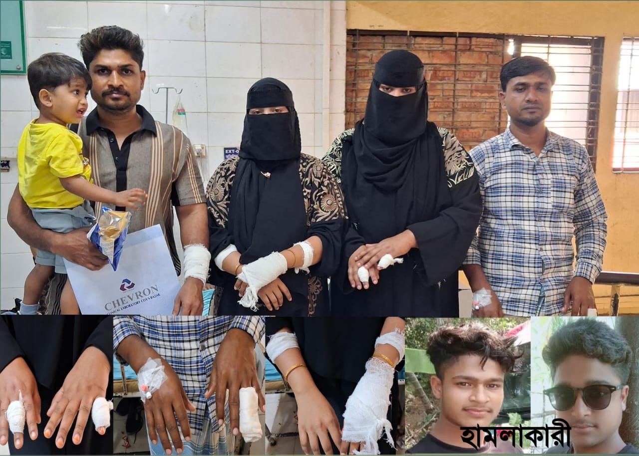 উখিয়ার জালিয়াপালংয়ে দাঁড়িপাল্লায় ভোট দেয়াকে কেন্দ্র করে হামলার অভিযোগ, নারীসহ আহত ৪