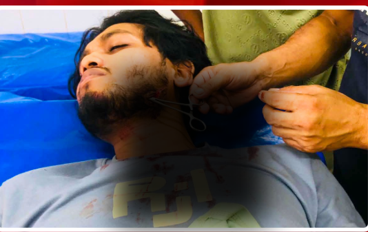 টেকনাফে পাগলকে নির্যাতনের প্রতিবাদ করায় যুবককে ছুরিকাঘাত: আহতের অবস্থা আশংকাজনক